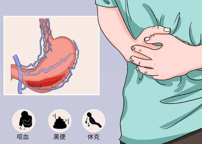 消化道出血卡通图片